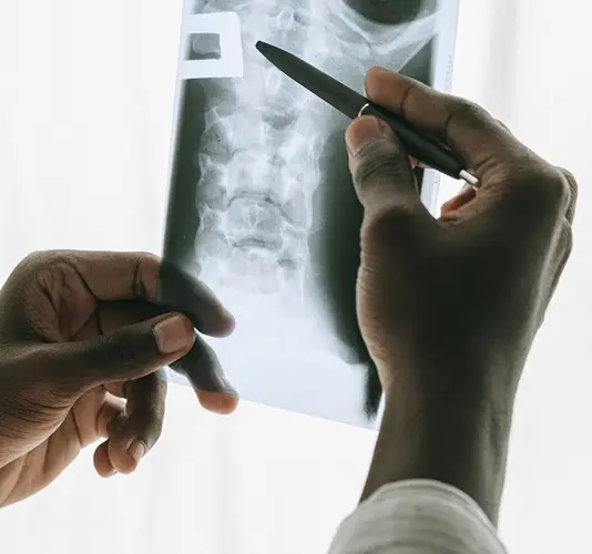 Spine Injury